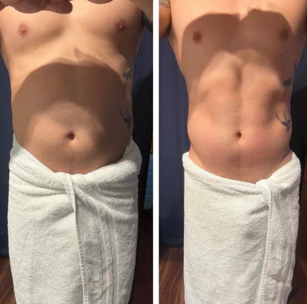 Body contouring results